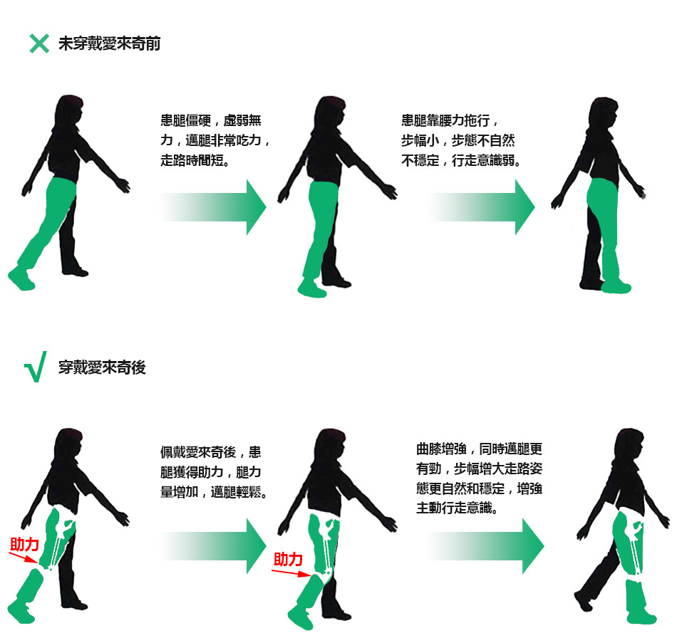 愛來奇無動力步行輔助器幫助偏癱康復過程